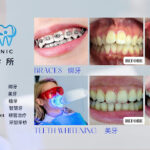 Star Dental Clinic Bukit Mertajam - Implant & Braces Centre 大山脚星牙科 种植牙和绑牙中心 - Bukit Mertajam
