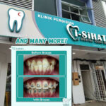 Klinik Pergigian I-Sihat (Pasir Gudang) - Johor Bahru