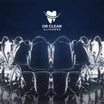 Dr Clear Aligners (Invisible Braces Dental Clinic) - Kuala Lumpur