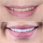 Smile Arts Dental Kota Damansara - Petaling Jaya