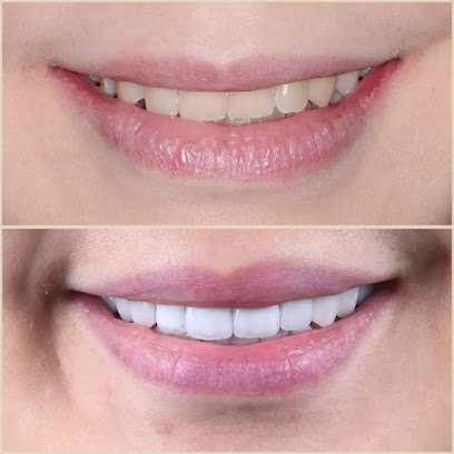Smile Arts Dental Kota Damansara - Petaling Jaya 2 AF1QipP3 aDoIvJp0JRv5FcZt5BXjFQRBqs838Q YhMmw408 h408 k no